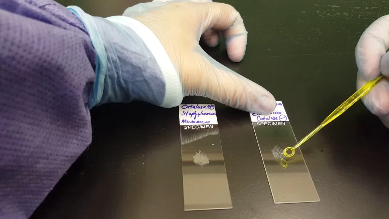 Lab technician performing catalase test on bacteria samples.